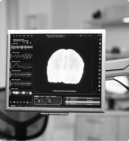 Monitor showing EEG brain-mapping data in a clinic