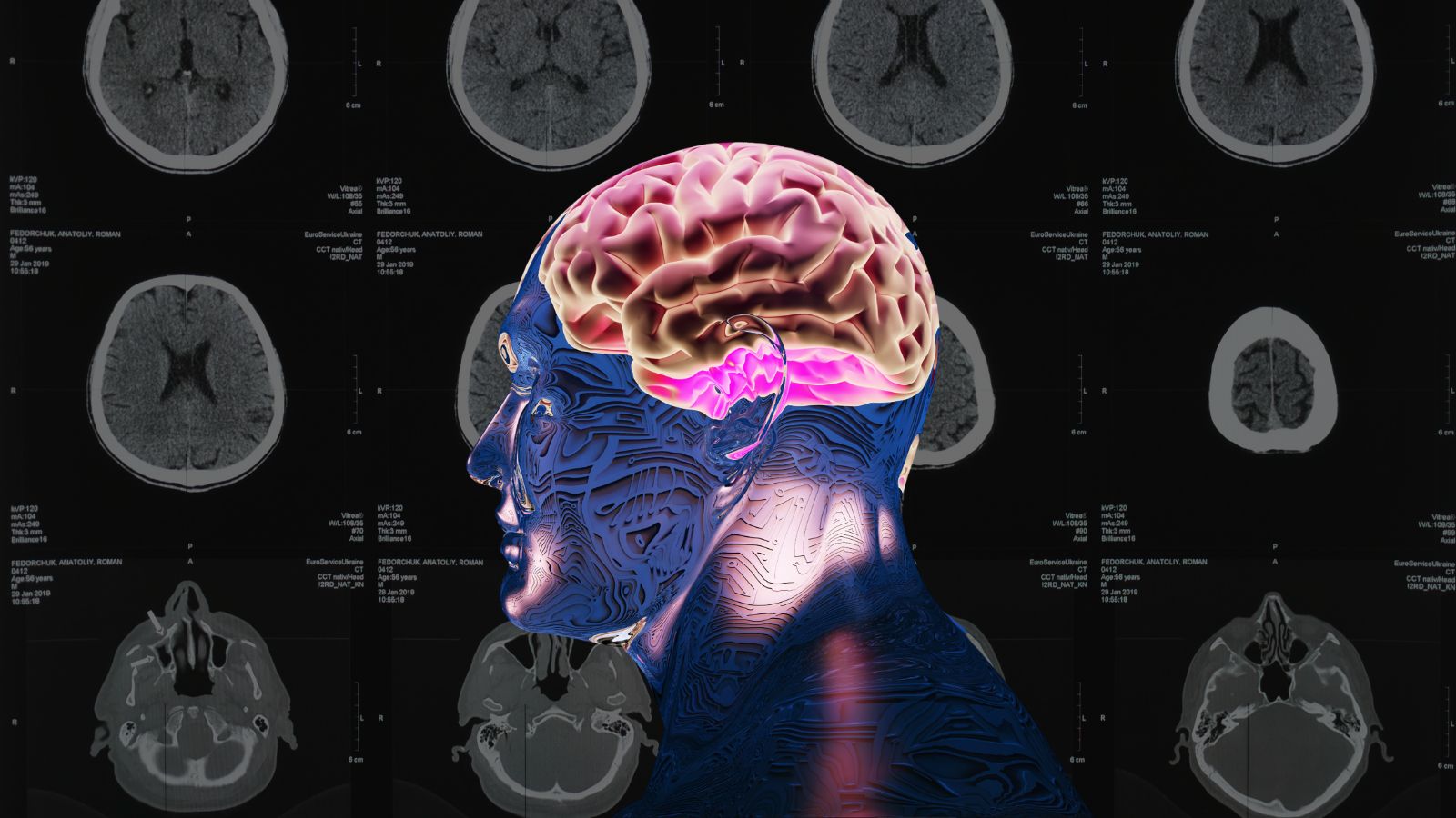 impact of new technology of brain health and mental health care