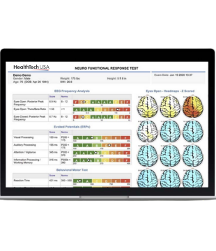 cutting edge QEEG equipment and neuroscan products