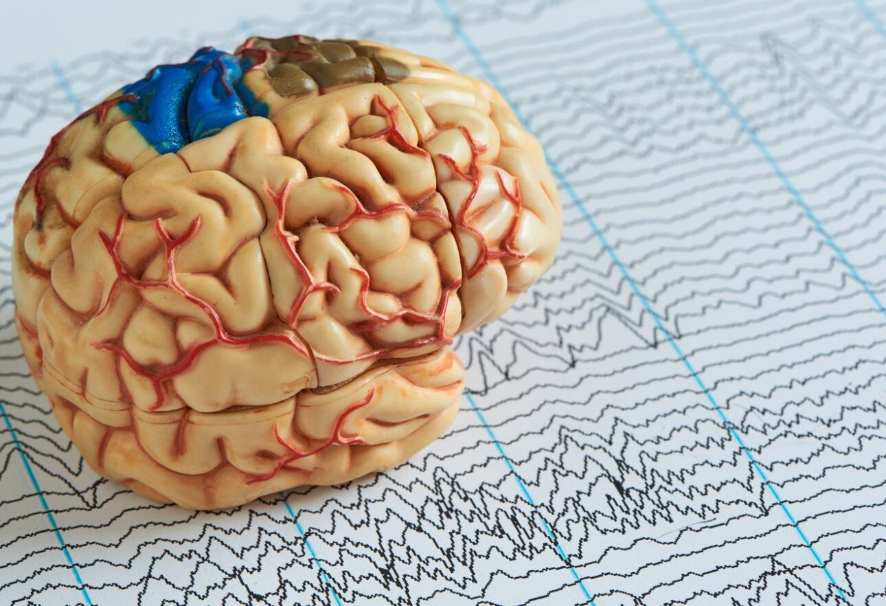 brain health technology mental health care QEEG and TMS machines