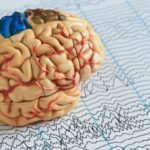 brain health technology mental health care QEEG and TMS machines