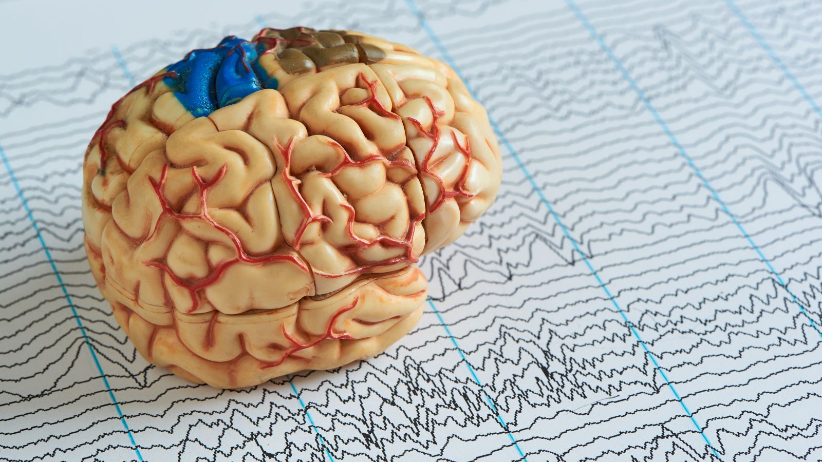 brain health technology mental health care QEEG and TMS machines