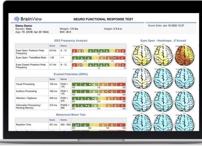 BrainView Products | HealthTech USA